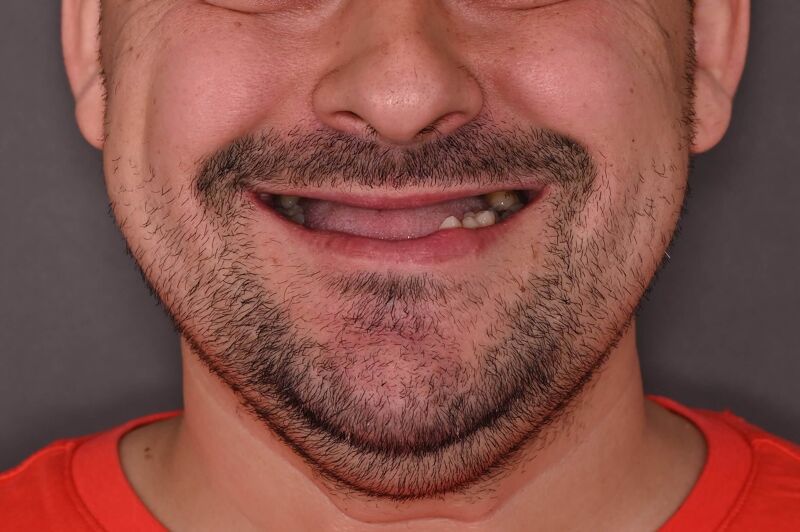 neagoe ionut - inainte